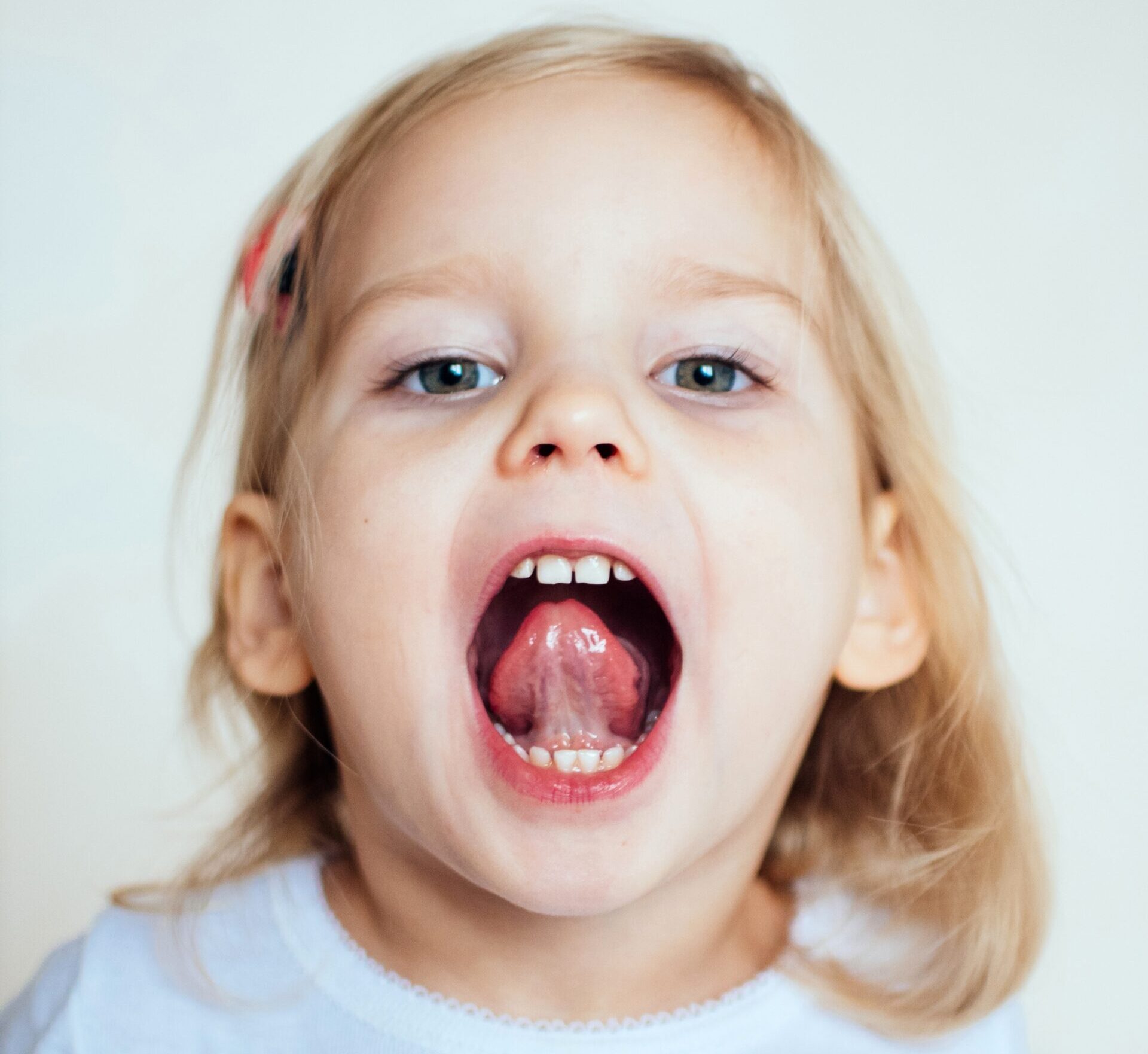 A photo of a young girl showing you the under side of her tongue and checking for a tongue tie