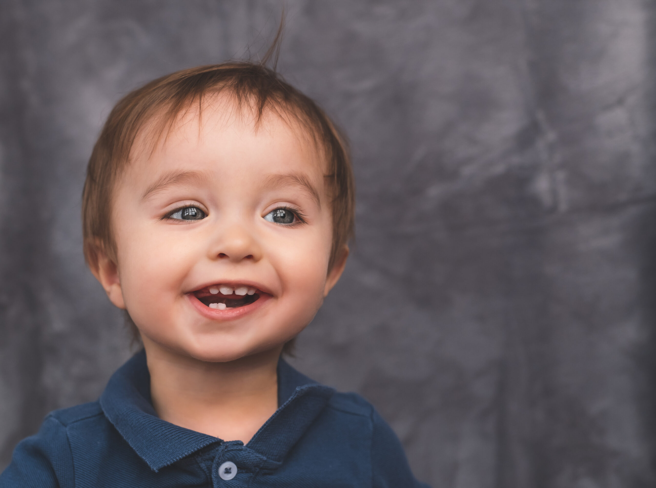 Photo of a toddler with an uneven face and ready for OMT treatments to help resolve it