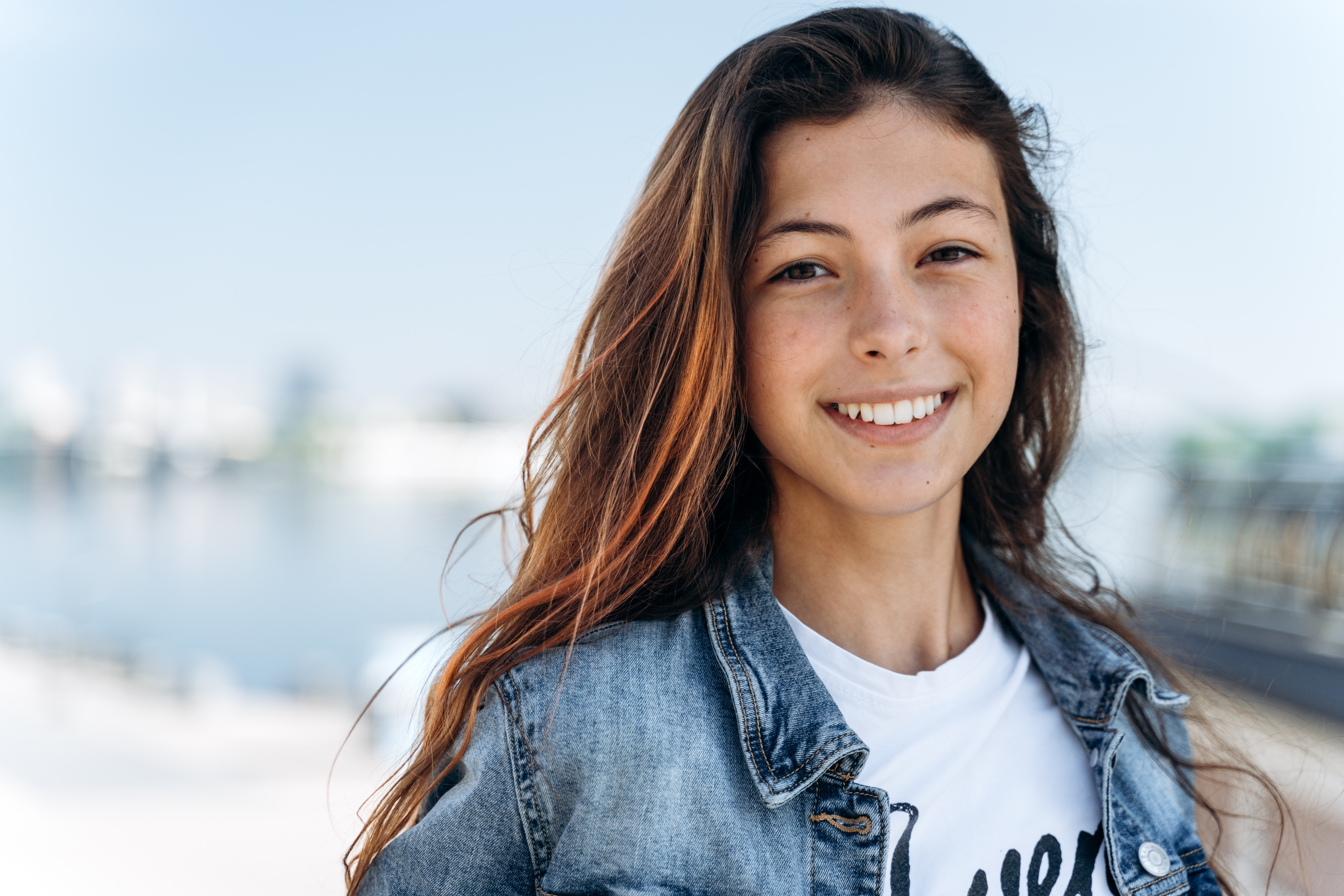 A photo of a girl who recently got OMT for mouth breathing